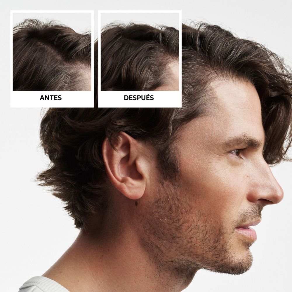 NIOXIN SYSTEM 2 - Kit - Traitement pour cheveux naturels visiblement affinés 3 unités
