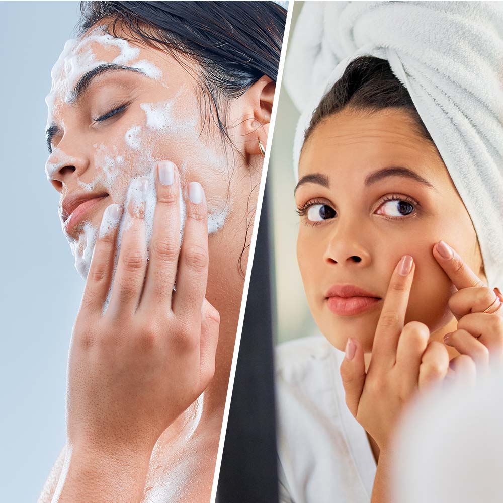 BIOVÈNE SALICILICO DETERGENTE SUPER VISO & CORPO punti neri + brufoli 200 ml