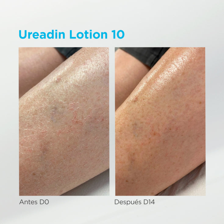 ISDIN UREADIN LOTION10 intense hydration 400 ml