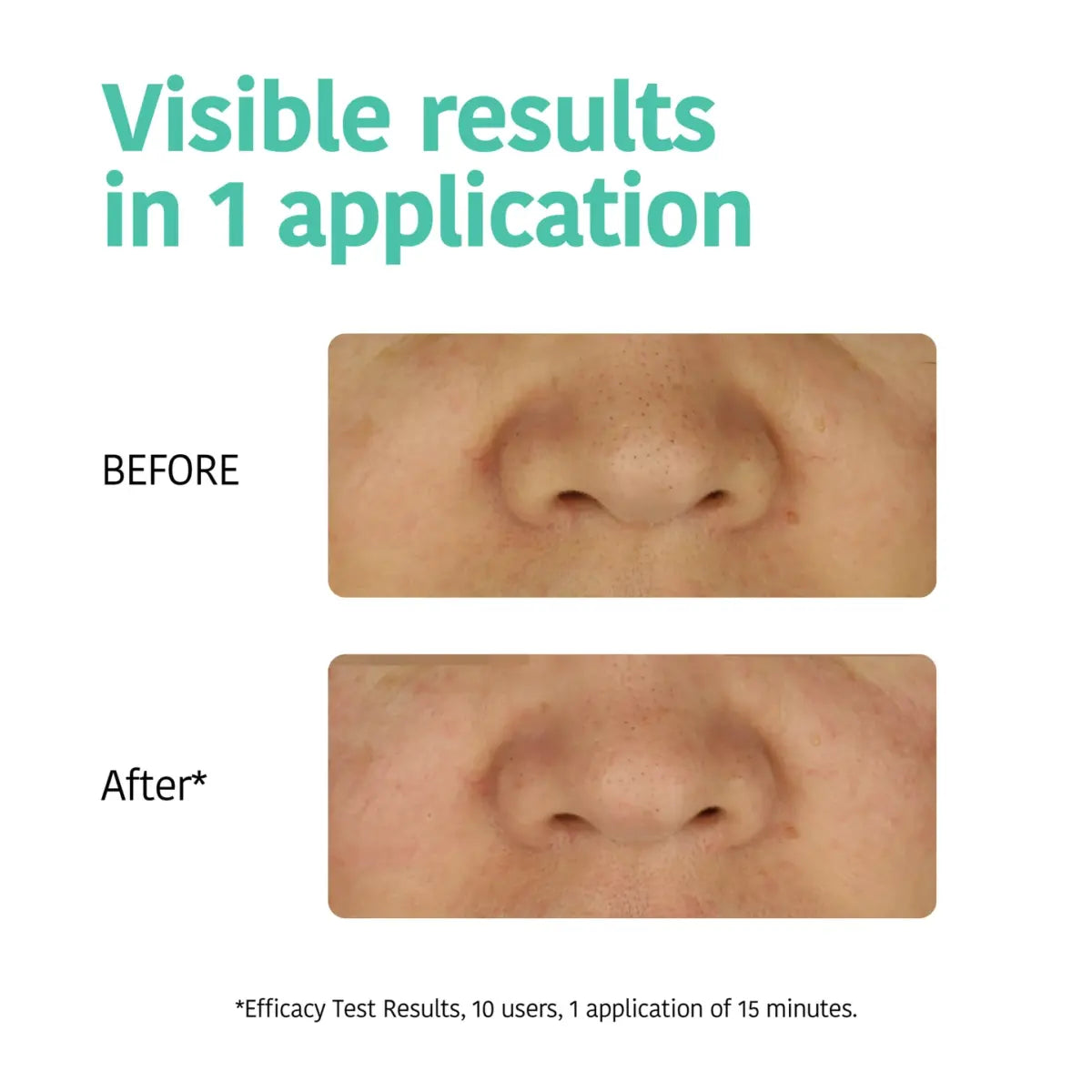 IROHA DETOX CHARCOAL BLACK nose strips 5 u