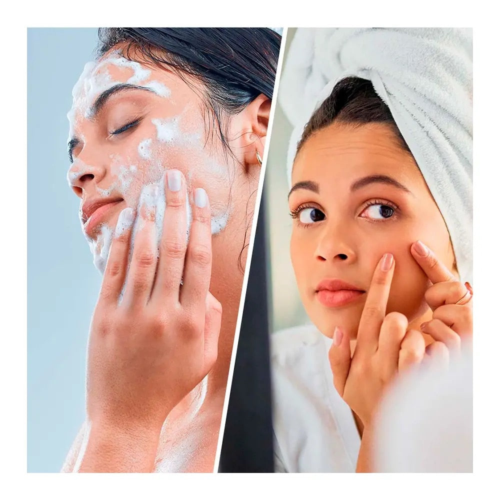 BIOVÈNE SALICILICO DETERGENTE SUPER VISO & CORPO punti neri + brufoli 200 ml