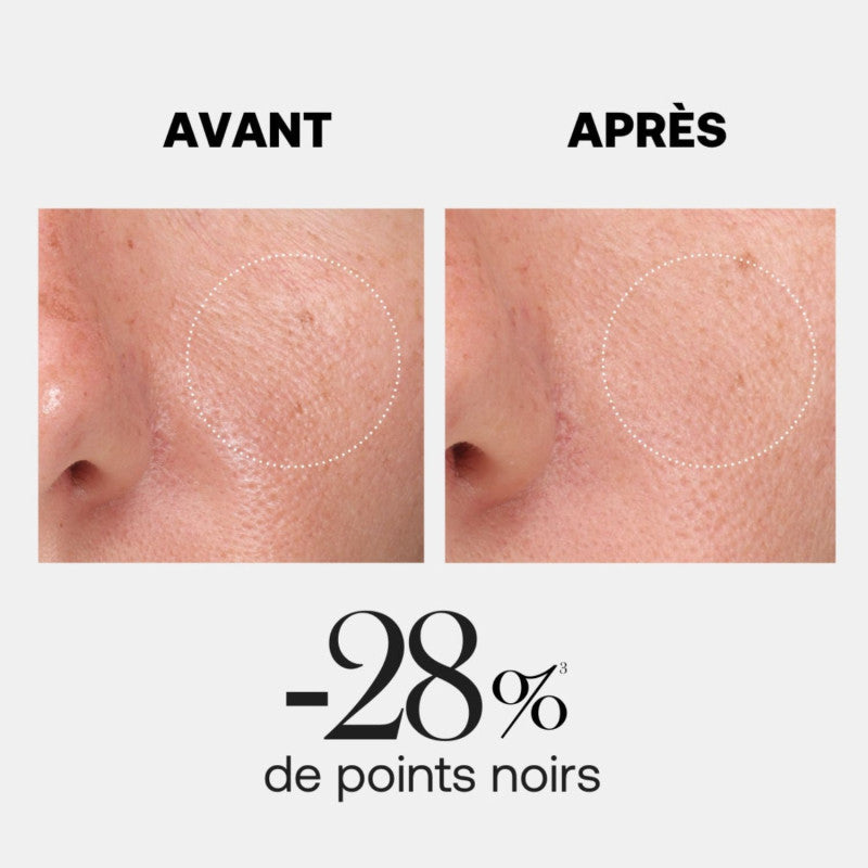 REXALINE HYALURX-BOOST gel exfoliant à la cellulose 15 ml